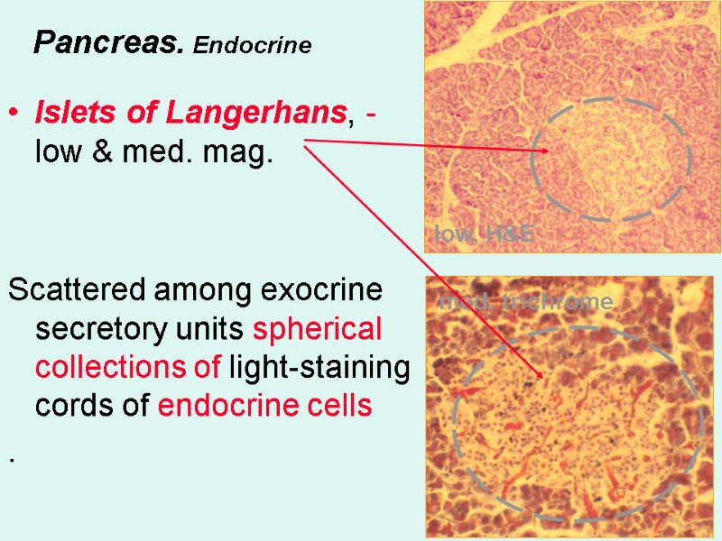 Pancreas. Endocrine Islets of Langerhans, - low & med. mag.   Scattered among